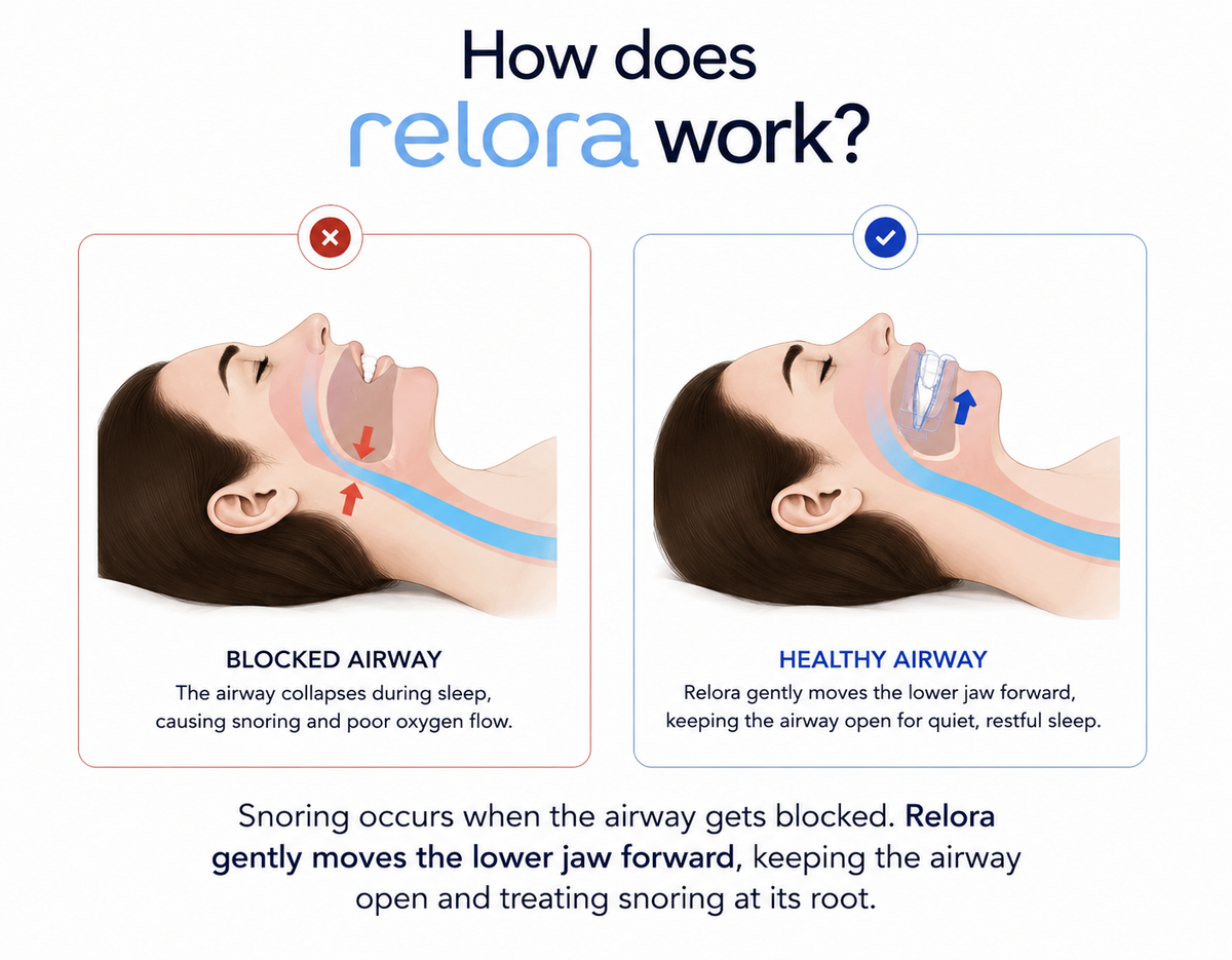 Relora Precision Adjustable Sleep & Snore Guard
