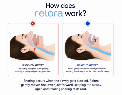 Relora Precision Adjustable Sleep & Snore Guard
